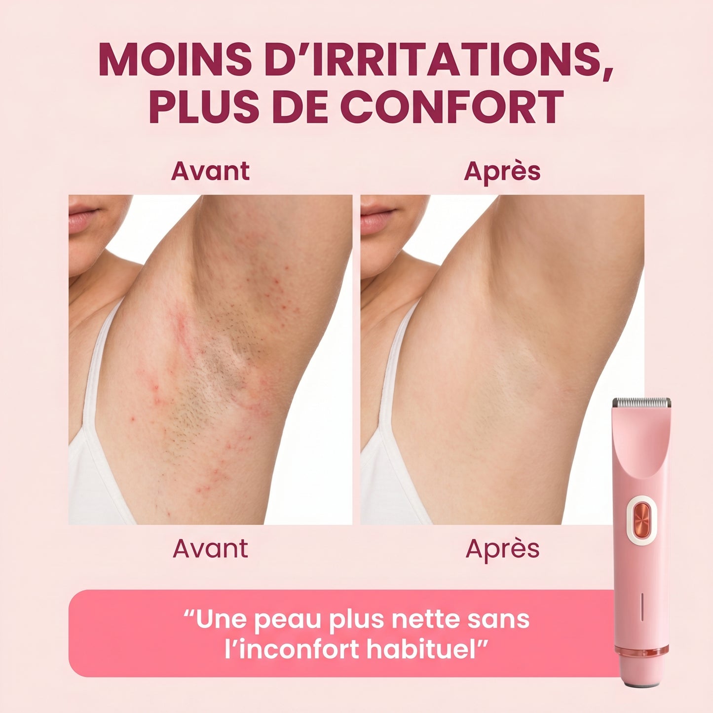 Soléna SoftTrim™ – Le rasoir beauté 2-en-1 pour peaux sensibles