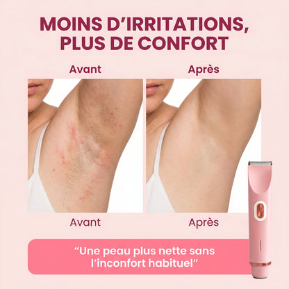 Soléna SoftTrim™ – Le rasoir beauté 2-en-1 pour peaux sensibles