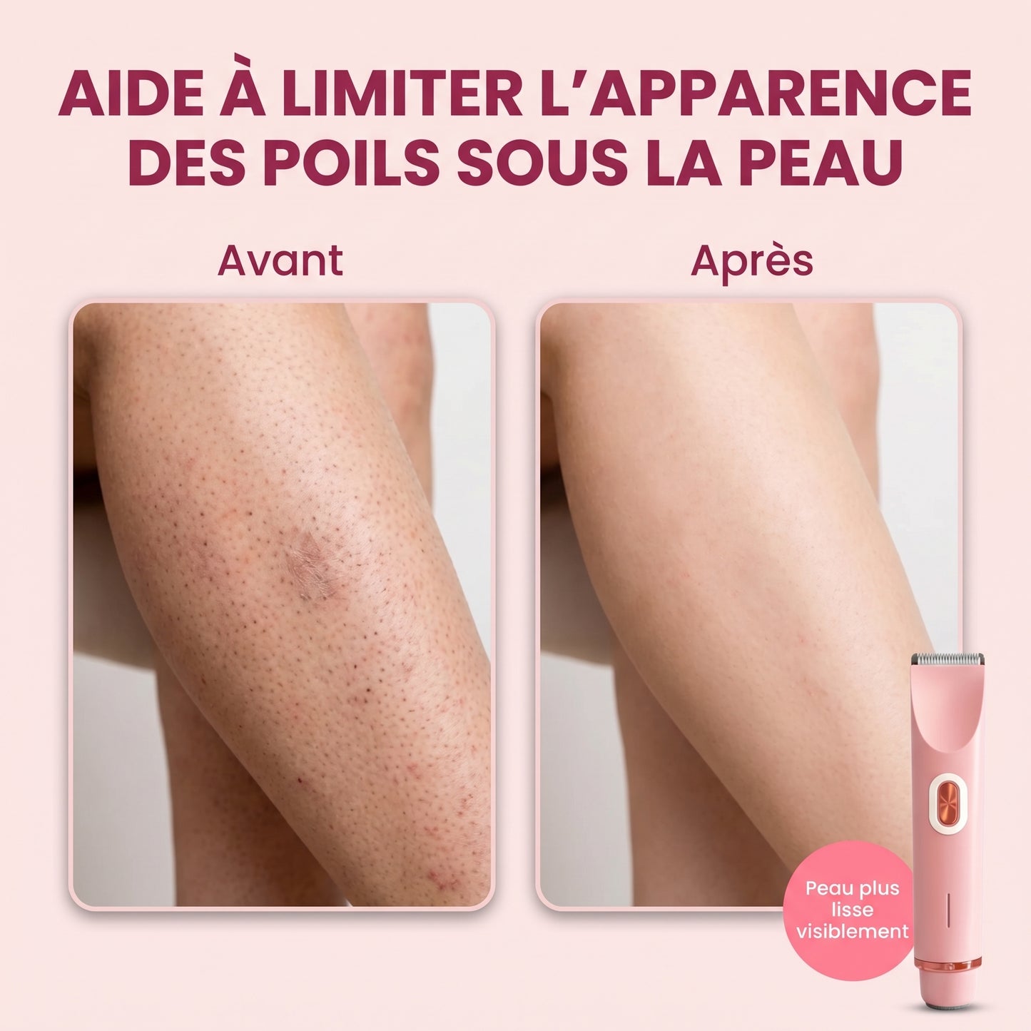 Soléna SoftTrim™ – Le rasoir beauté 2-en-1 pour peaux sensibles